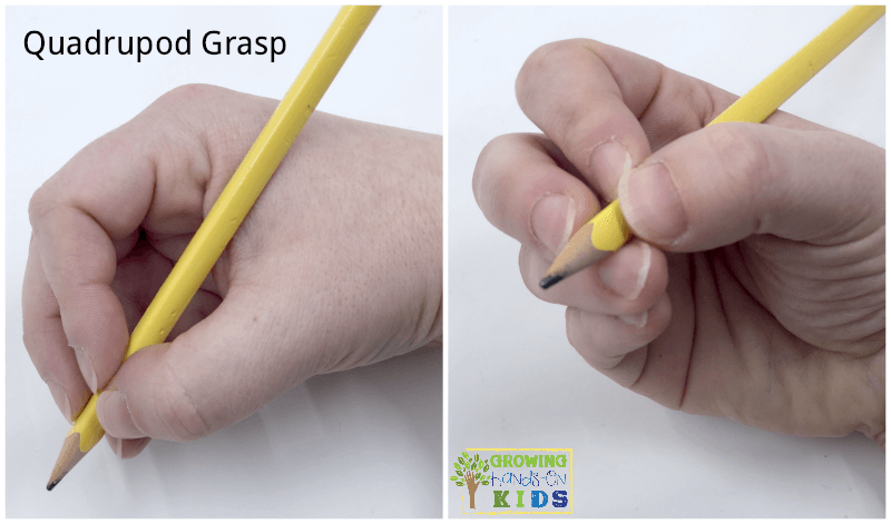 pronated pencil grip